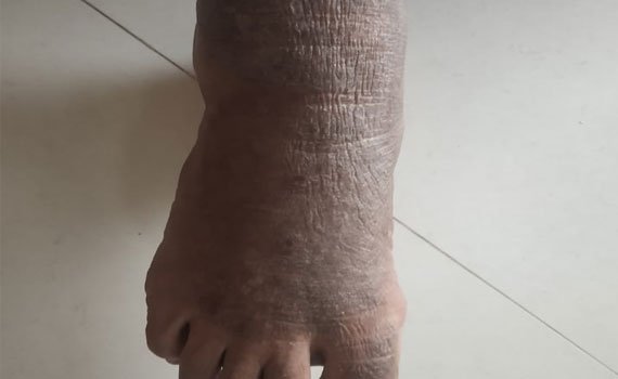 treat-gallery-after-1