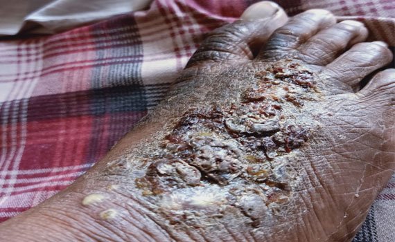 treat-gallery-before-1